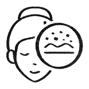 Dull + uneven skin tone